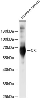 CFI Rabbit Polyclonal Antibody