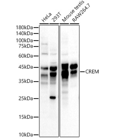 CREM Rabbit Polyclonal Antibody