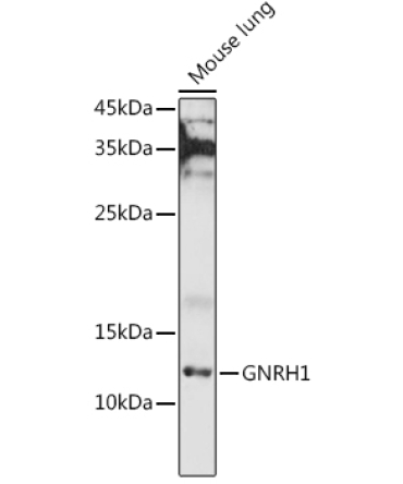 GNRH1 Rabbit Polyclonal Antibody