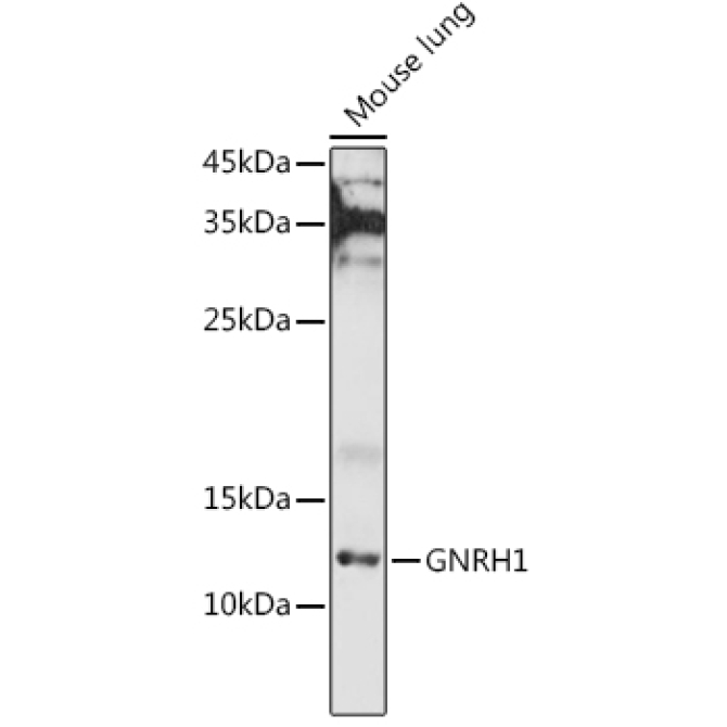GNRH1 Rabbit Polyclonal Antibody