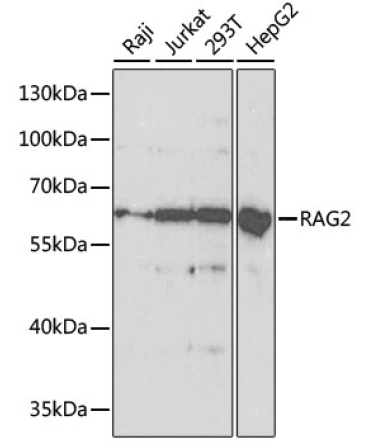 RAG2 Rabbit Polyclonal Antibody [KO Validated]