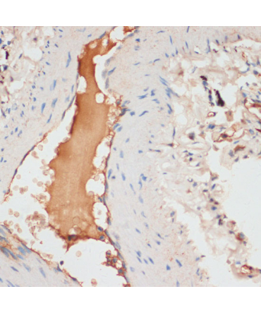 APOC1 Rabbit Polyclonal Antibody