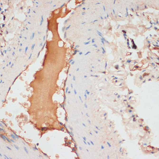 APOC1 Rabbit Polyclonal Antibody