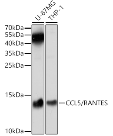 CCL5/RANTES Rabbit Polyclonal Antibody