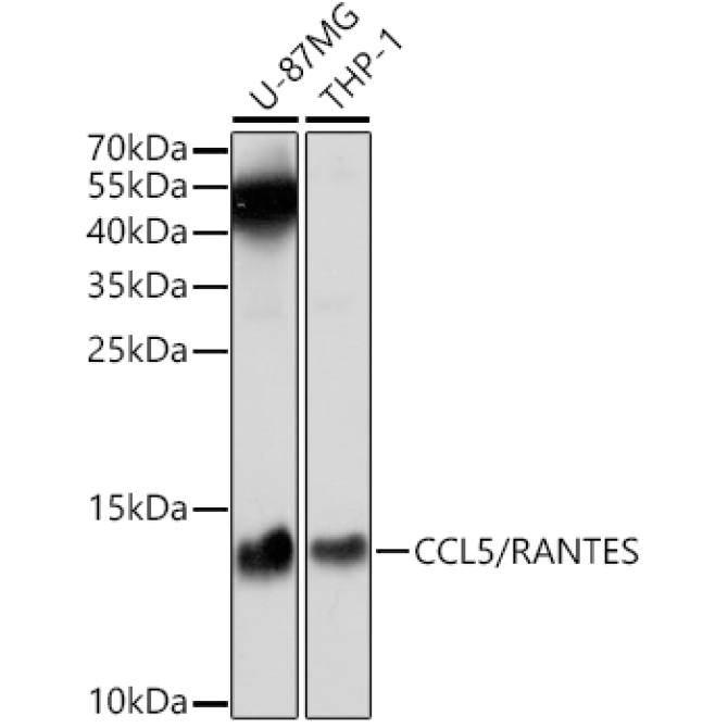 CCL5/RANTES Rabbit Polyclonal Antibody