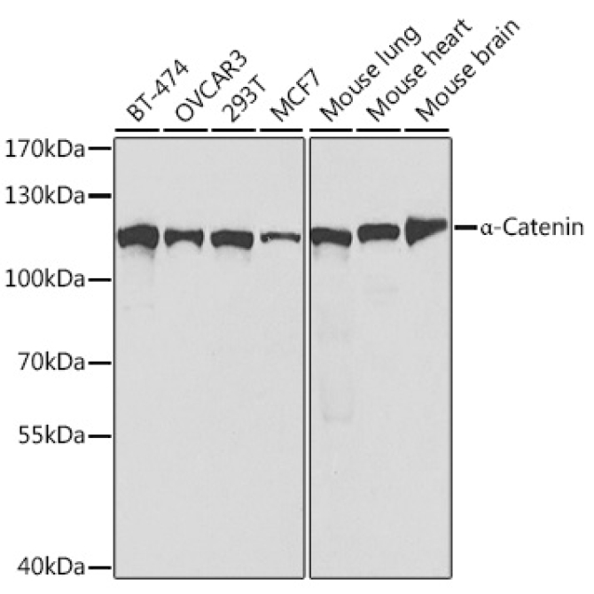 Alpha-Catenin Rabbit Polyclonal Antibody [KO Validated]
