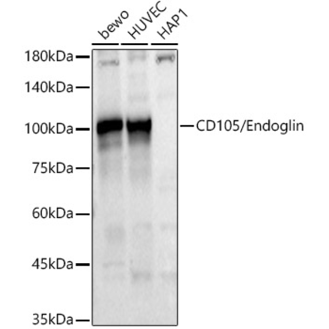 CD105/Endoglin Rabbit Polyclonal Antibody