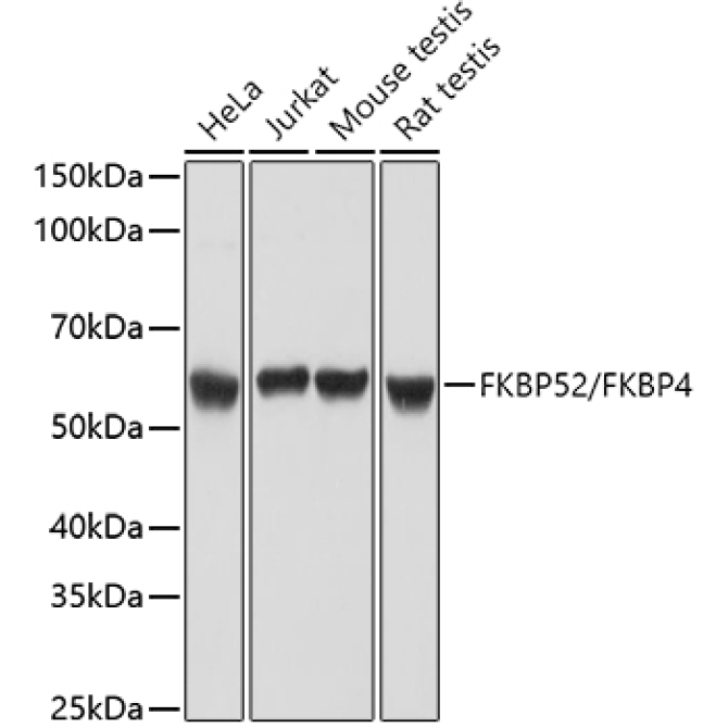 FKBP52/FKBP4 Rabbit Polyclonal Antibody