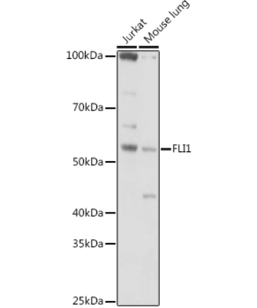 FLI1 Rabbit Polyclonal Antibody