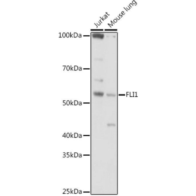 FLI1 Rabbit Polyclonal Antibody