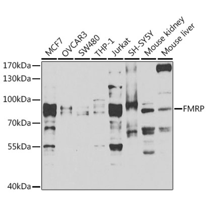 FMRP Rabbit Polyclonal Antibody