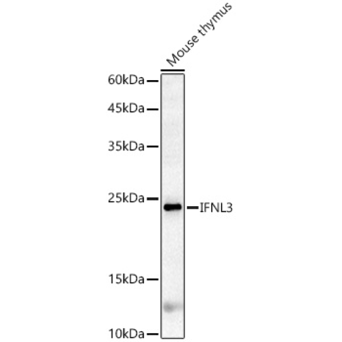 IFNL3 Rabbit Polyclonal Antibody
