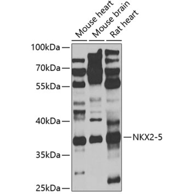 NKX2-5 Rabbit Polyclonal Antibody