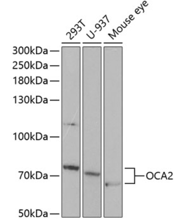 OCA2 Rabbit Polyclonal Antibody