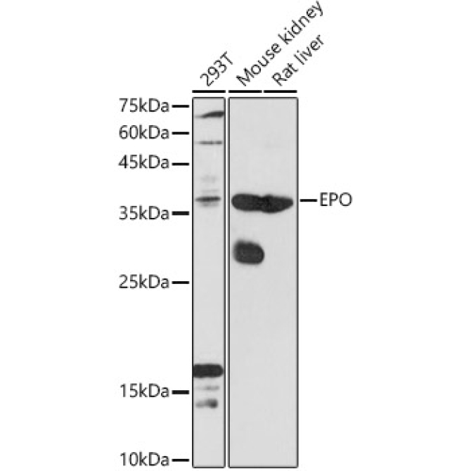 EPO Rabbit Polyclonal Antibody