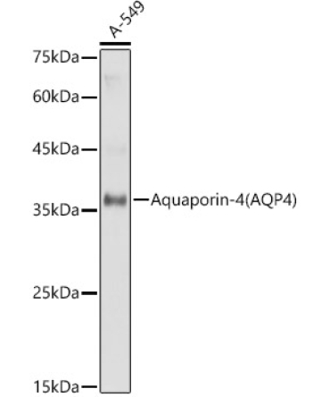 Aquaporin-4 (AQP4) Rabbit Polyclonal Antibody