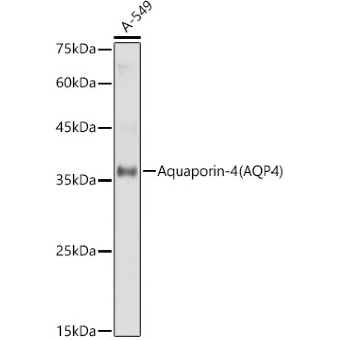 Aquaporin-4 (AQP4) Rabbit Polyclonal Antibody