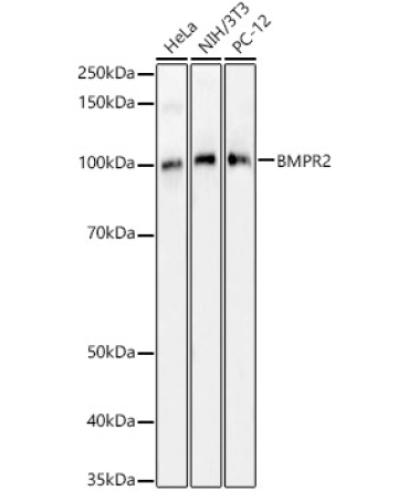 BMPR2 Rabbit Polyclonal Antibody