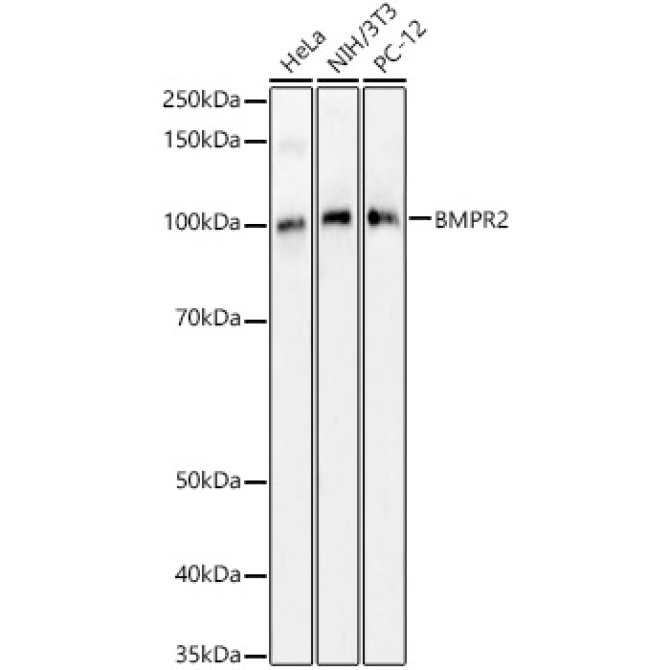 BMPR2 Rabbit Polyclonal Antibody