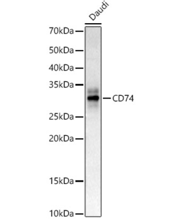 CD74 Rabbit Polyclonal Antibody