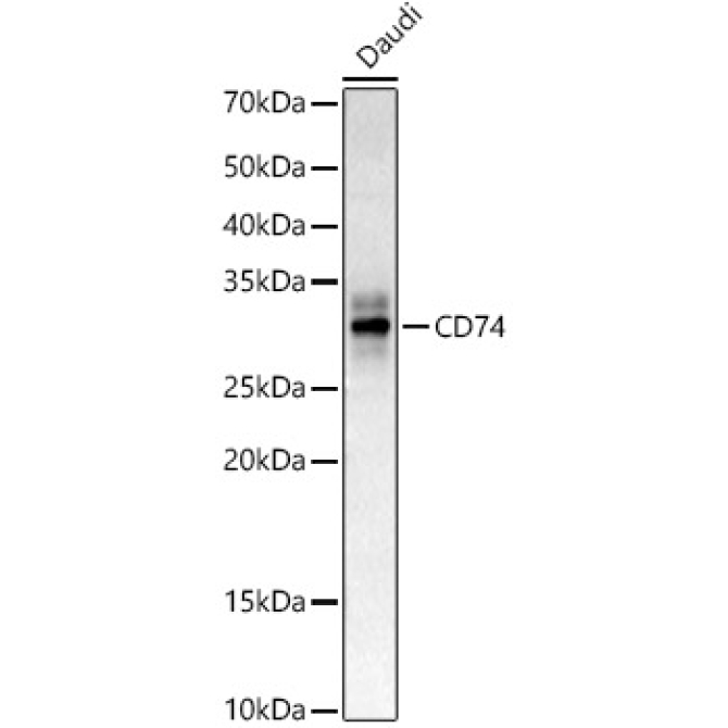 CD74 Rabbit Polyclonal Antibody