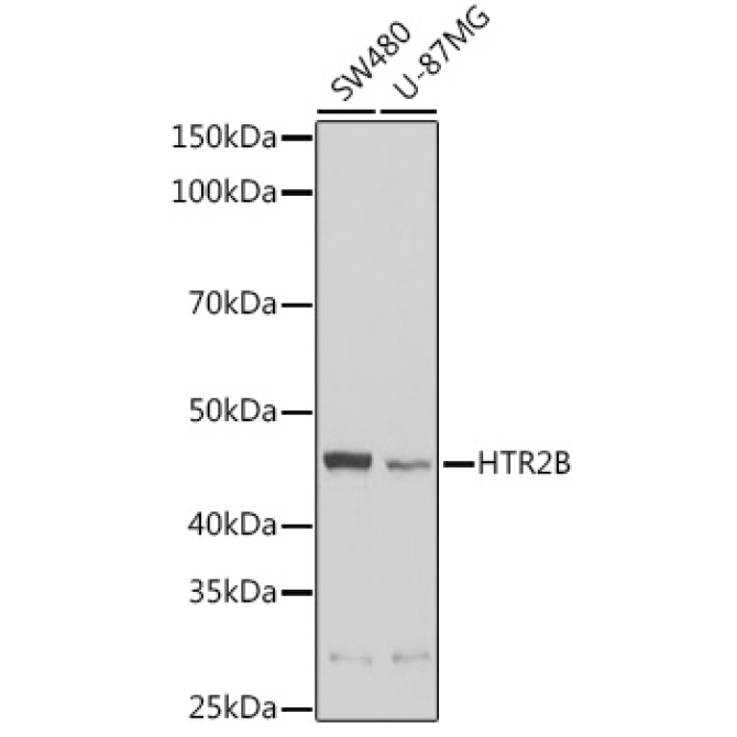HTR2B Rabbit Polyclonal Antibody
