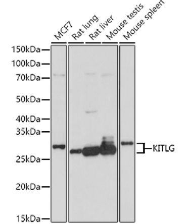 KITLG Rabbit Polyclonal Antibody