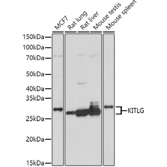 KITLG Rabbit Polyclonal Antibody