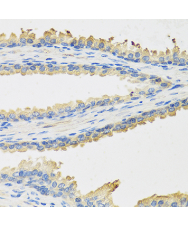Leptin Rabbit Polyclonal Antibody