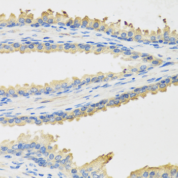 Leptin Rabbit Polyclonal Antibody