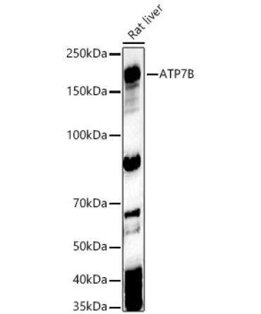 ATP7B Rabbit Polyclonal Antibody