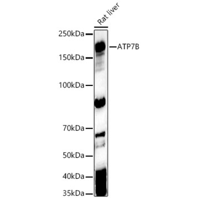 ATP7B Rabbit Polyclonal Antibody
