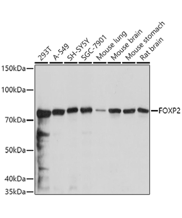 FOXP2 Rabbit Polyclonal Antibody