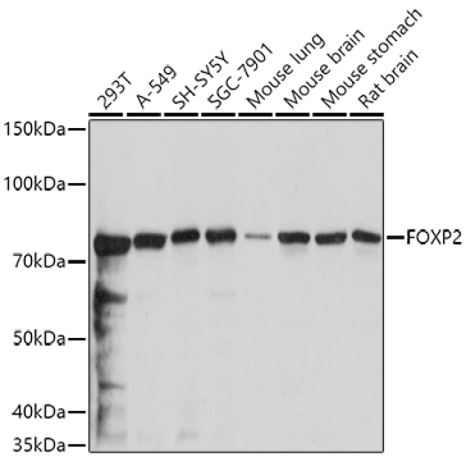 FOXP2 Rabbit Polyclonal Antibody