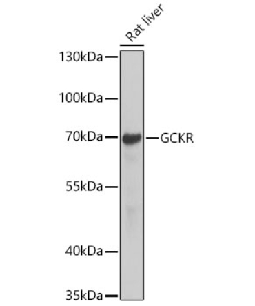 GCKR Rabbit Polyclonal Antibody