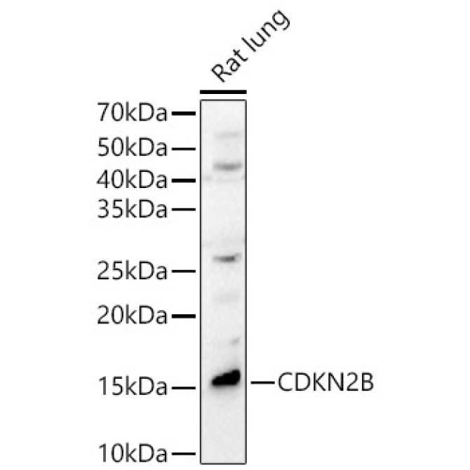 CDKN2B Rabbit Polyclonal Antibody