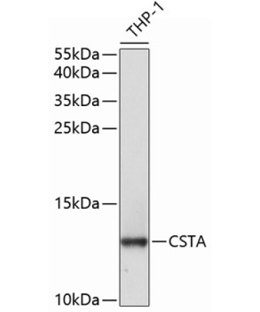 CSTA Rabbit Polyclonal Antibody