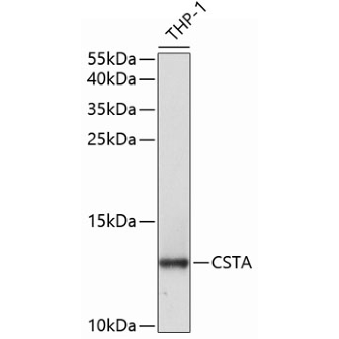 CSTA Rabbit Polyclonal Antibody