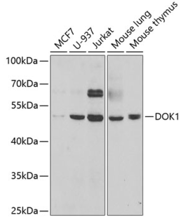 DOK1 Rabbit Polyclonal Antibody