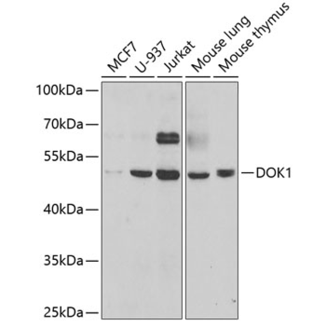DOK1 Rabbit Polyclonal Antibody