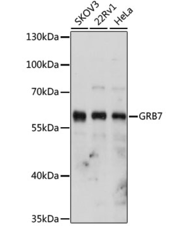 GRB7 Rabbit Polyclonal Antibody