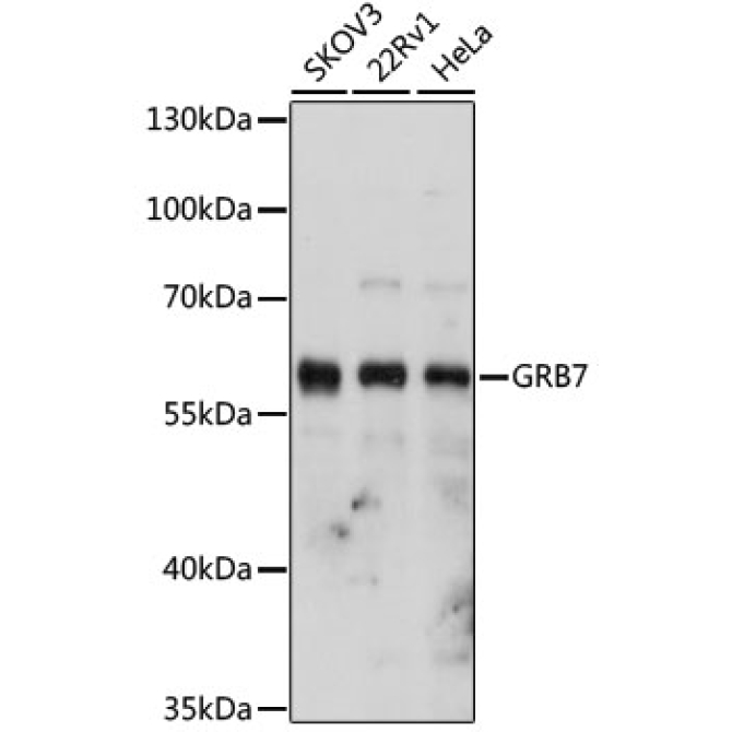 GRB7 Rabbit Polyclonal Antibody