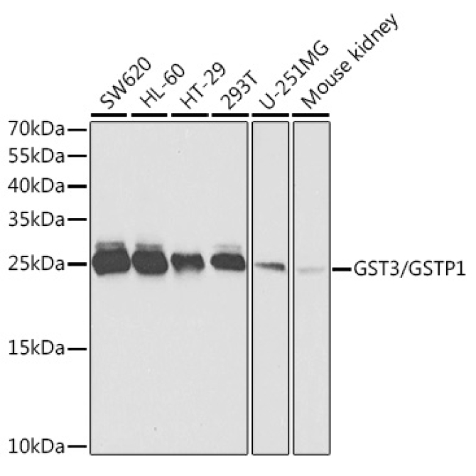 GST3/GSTP1 Rabbit Polyclonal Antibody