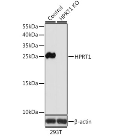 HPRT1 Rabbit Polyclonal Antibody [KO Validated]