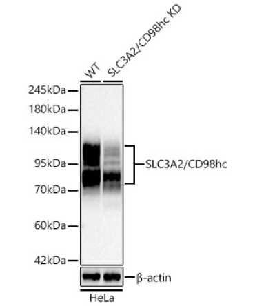 SLC3A2/CD98hc Rabbit Polyclonal Antibody [KD Validated]
