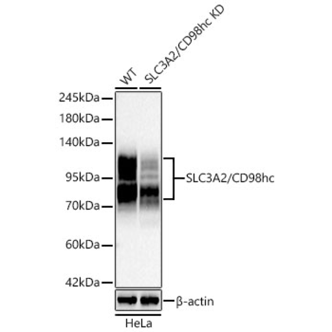 SLC3A2/CD98hc Rabbit Polyclonal Antibody [KD Validated]