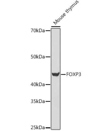 FOXP3 Rabbit Polyclonal Antibody