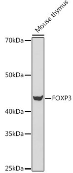 FOXP3 Rabbit Polyclonal Antibody