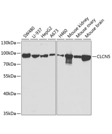 CLCN5 Rabbit Polyclonal Antibody