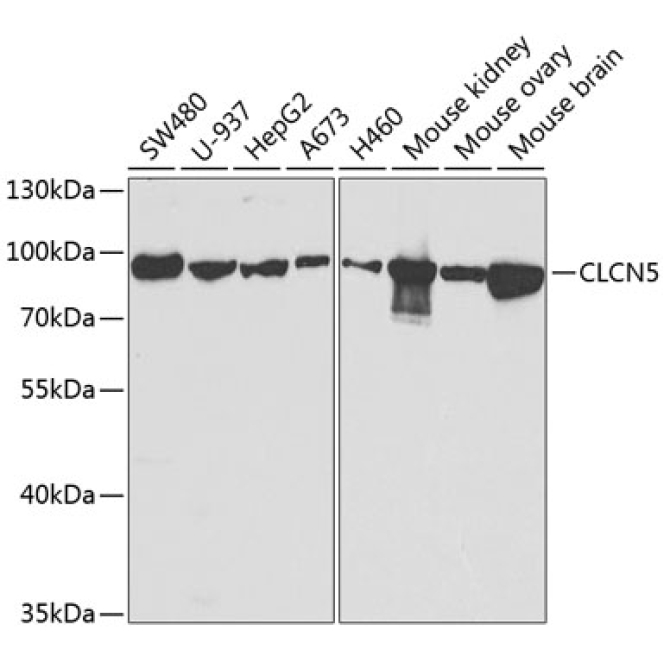 CLCN5 Rabbit Polyclonal Antibody